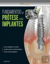 Fundamentos da Prótese Sobre Implantes