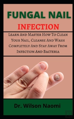 Bertrand.pt - Fungal Nail Infection