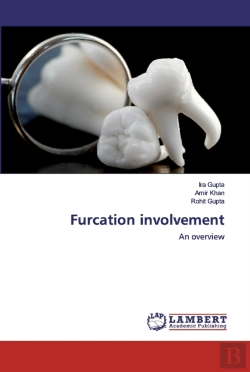 Bertrand.pt - Furcation Involvement