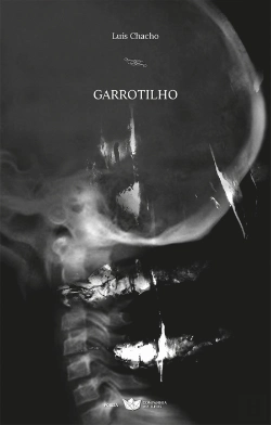 Bertrand.pt - Garrotilho