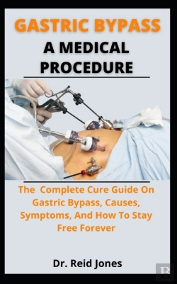 Bertrand.pt - Gastric Bypass A Medical Procedure