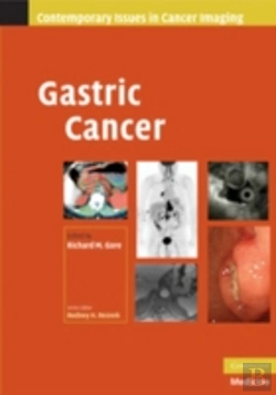 Bertrand.pt - Gastric Cancer