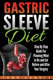 Gastric Sleeve Diet