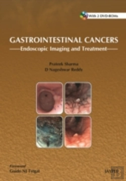 Bertrand.pt - Gastrointestinal Cancers: