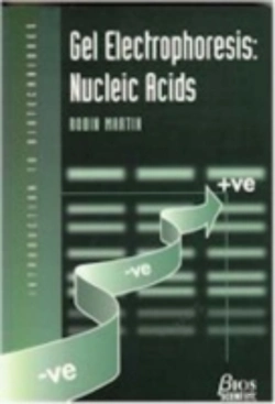 Bertrand.pt - Gel Electrophoresis: Nucleic Acids
