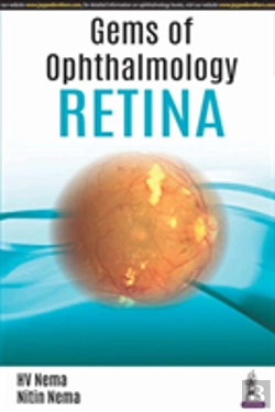 Bertrand.pt - Gems Of Ophthalmology: Retina