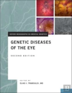 Bertrand.pt - Genetic Diseases Of The Eye
