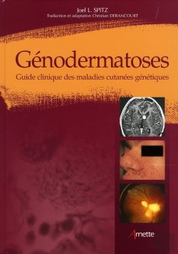 Bertrand.pt - Génodermatoses ; Guide Clinique Des Maladies Cutanées Génétiques
