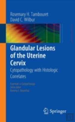 Bertrand.pt - Glandular Lesions Of The Uterine Cervix