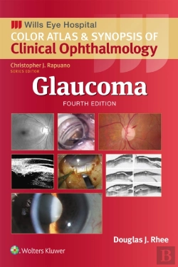 Bertrand.pt - Glaucoma