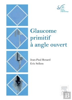 Bertrand.pt - Glaucome Primitif À Angle Ouvert
