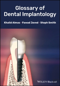 Bertrand.pt - Glossary Of Dental Implantology