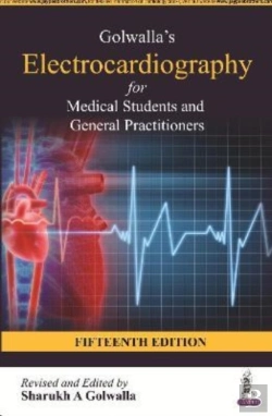 Bertrand.pt - Golwalla'S Electrocardiography For Medical Students And General Practitioners
