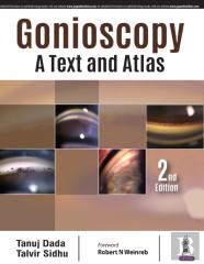 Gonioscopy: A Text And Atlas