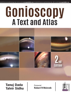 Bertrand.pt - Gonioscopy: A Text And Atlas