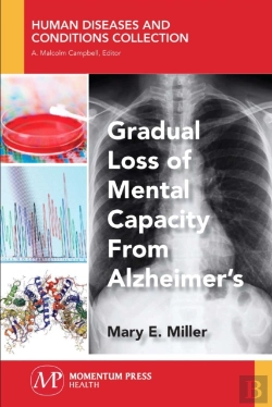 Bertrand.pt - Gradual Loss Of Mental Capacity From Alzheimer'S