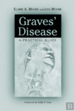 Bertrand.pt - Graves' Disease