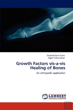 Bertrand.pt - Growth Factors Vis-A-Vis Healing Of Bones