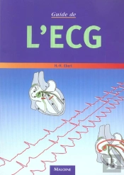 Guide De L'Ecg