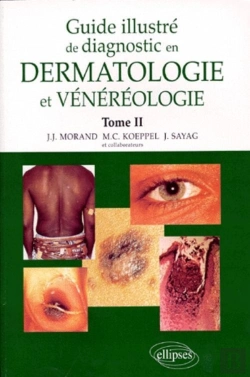 Bertrand.pt - Guide Illustré De Diagnostic En Dermatologie Et Vénéréologie - Tome 2