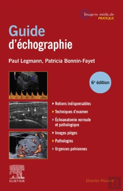 Bertrand.pt - Guide Pratique D'Echographie