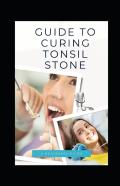 Guide To Curing Tonsil Stone