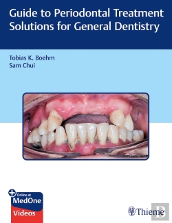 Bertrand.pt - Guide To Periodontal Treatment Solutions For General Dentistry
