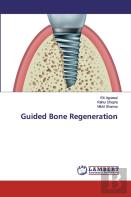 Guided Bone Regeneration