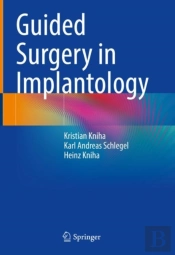 Guided Surgery In Implantology