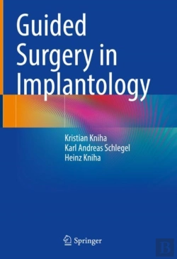 Bertrand.pt - Guided Surgery In Implantology