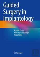 Guided Surgery In Implantology