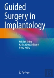 Guided Surgery In Implantology