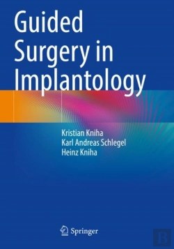 Bertrand.pt - Guided Surgery In Implantology
