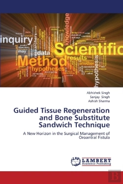 Bertrand.pt - Guided Tissue Regeneration And Bone Substitute Sandwich Technique
