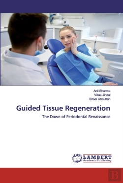 Bertrand.pt - Guided Tissue Regeneration