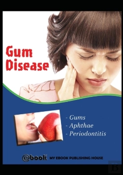Bertrand.pt - Gum Disease