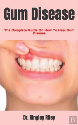 Bertrand.pt - Gum Disease