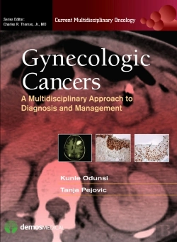 Bertrand.pt - Gynecologic Cancers