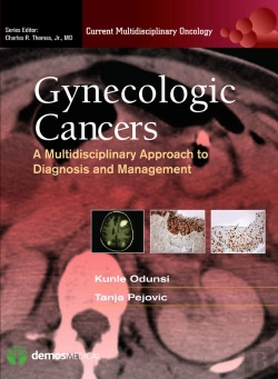 Bertrand.pt - Gynecologic Cancers