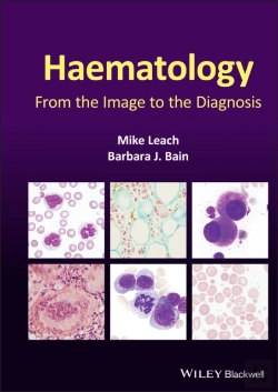 Bertrand.pt - Haematology