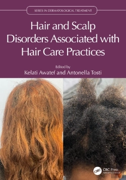 Bertrand.pt - Hair And Scalp Disorders Associated With Hair Care Practices