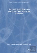 Hair And Scalp Disorders Associated With Hair Care Practices