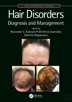 Bertrand.pt - Hair Disorders