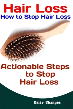 Bertrand.pt - Hair Loss