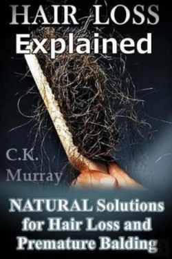Bertrand.pt - Hair Loss Explained