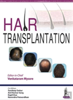 Bertrand.pt - Hair Transplantation