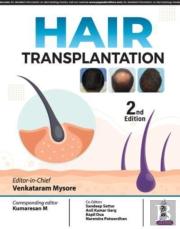 Hair Transplantation