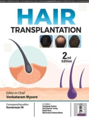 Hair Transplantation