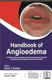 Handbook Of Angioedema