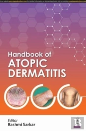 Handbook Of Atopic Dermatitis